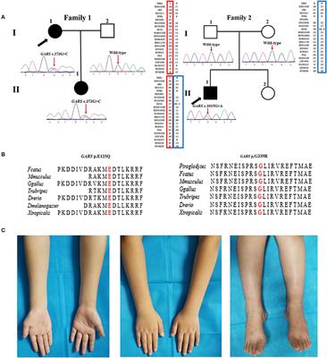 Genetic and Clinical Features in 24 Chinese Distal Hereditary Motor Neuropathy Families